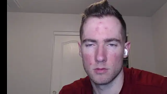 rawdawgrex online show from March 7, 7:17 am